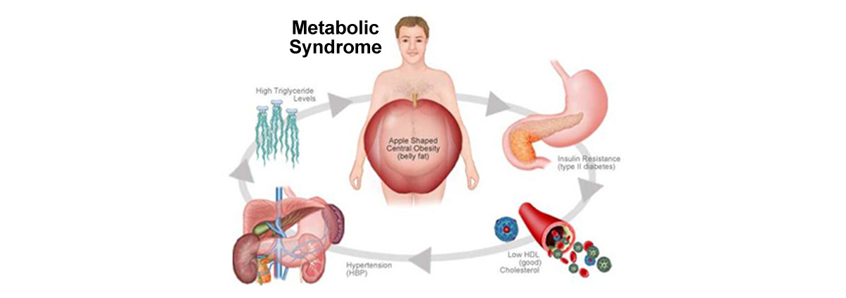 MetabolicSyndrome