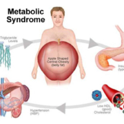 MetabolicSyndrome