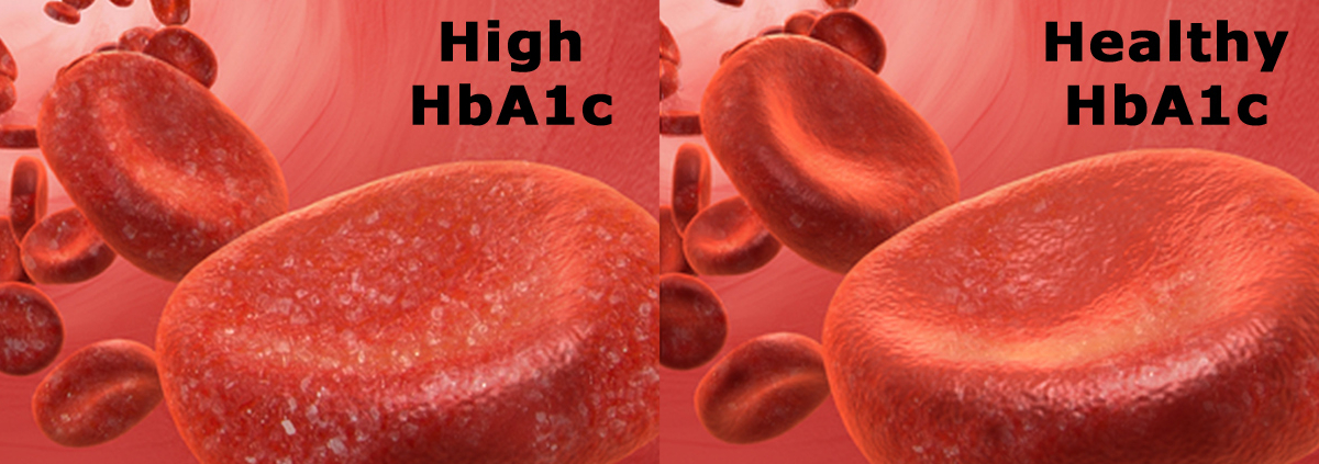 HbA1C