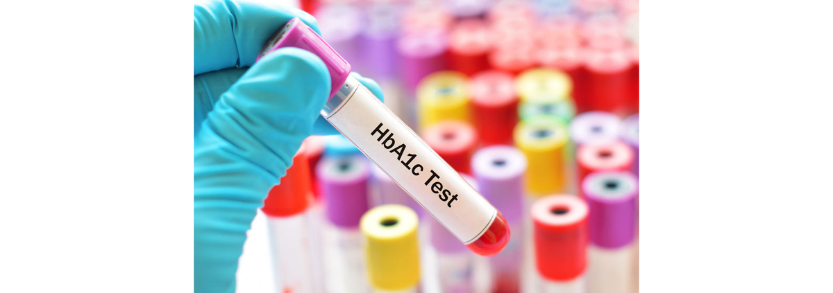 HbA1Ctest