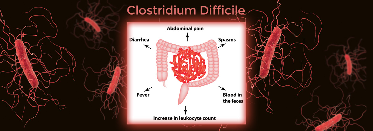 ClostridiumDifficile