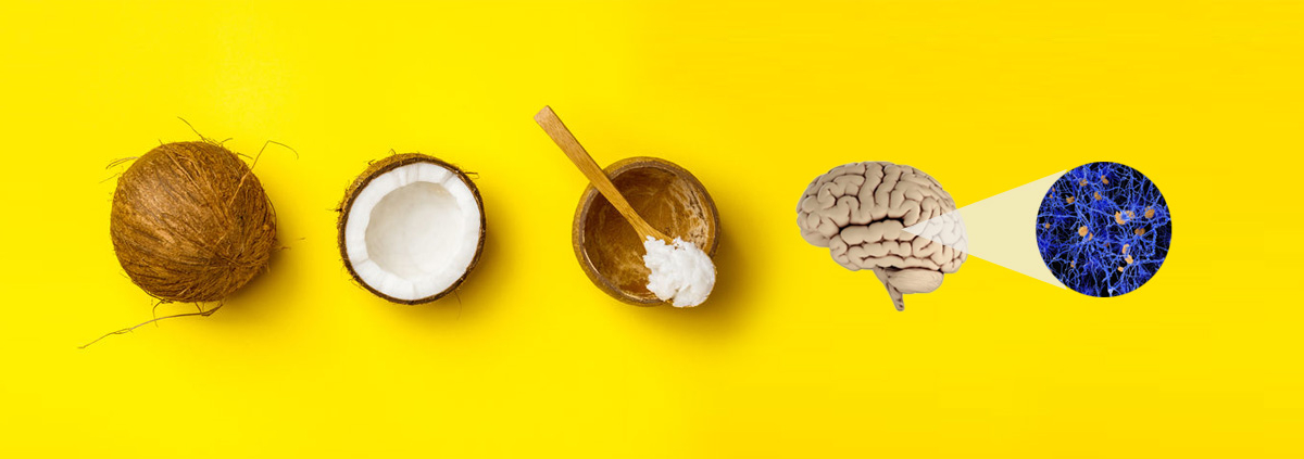 CoconutOilAndAlzheimers