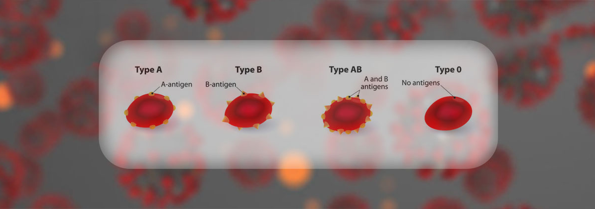 COVID-19andBloodType