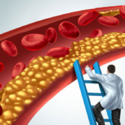 ArterialPlaqueStudy