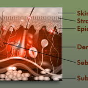 SkinStructure