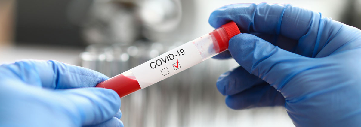 COVID-19-test-tube