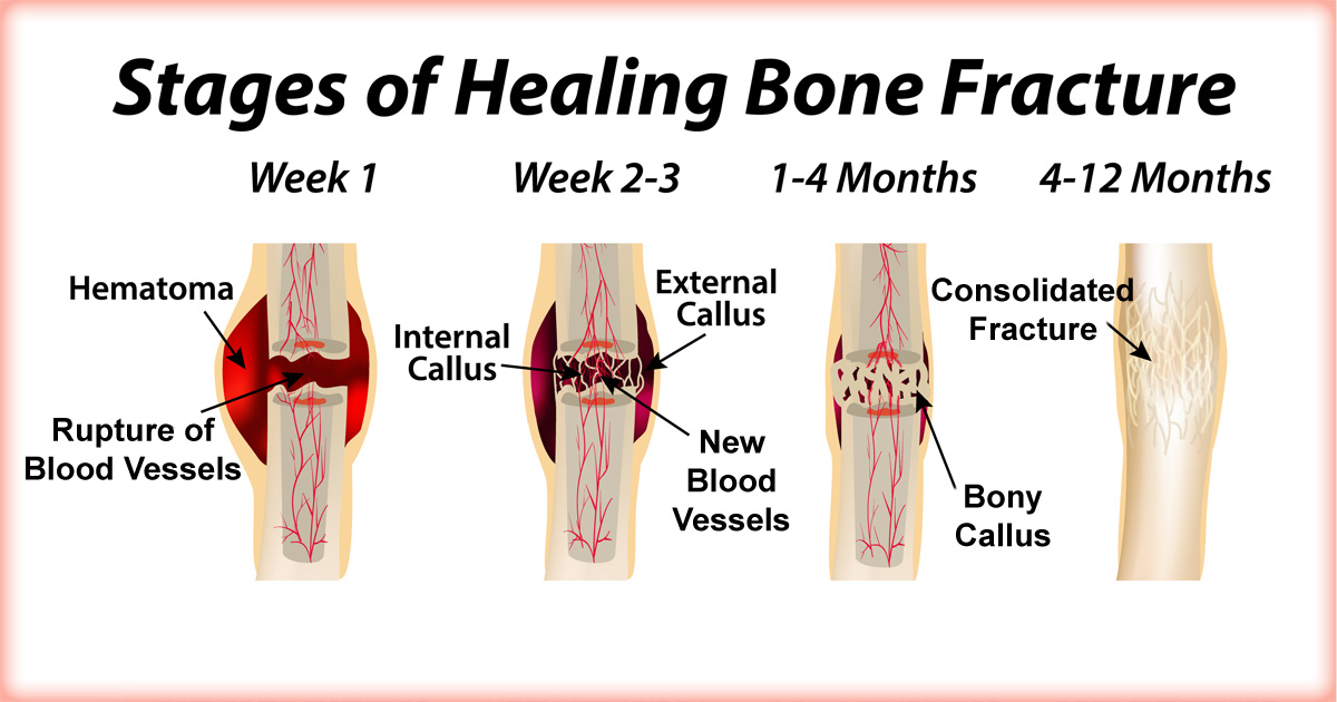 HealingBone