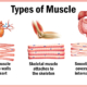 Muscle-Types
