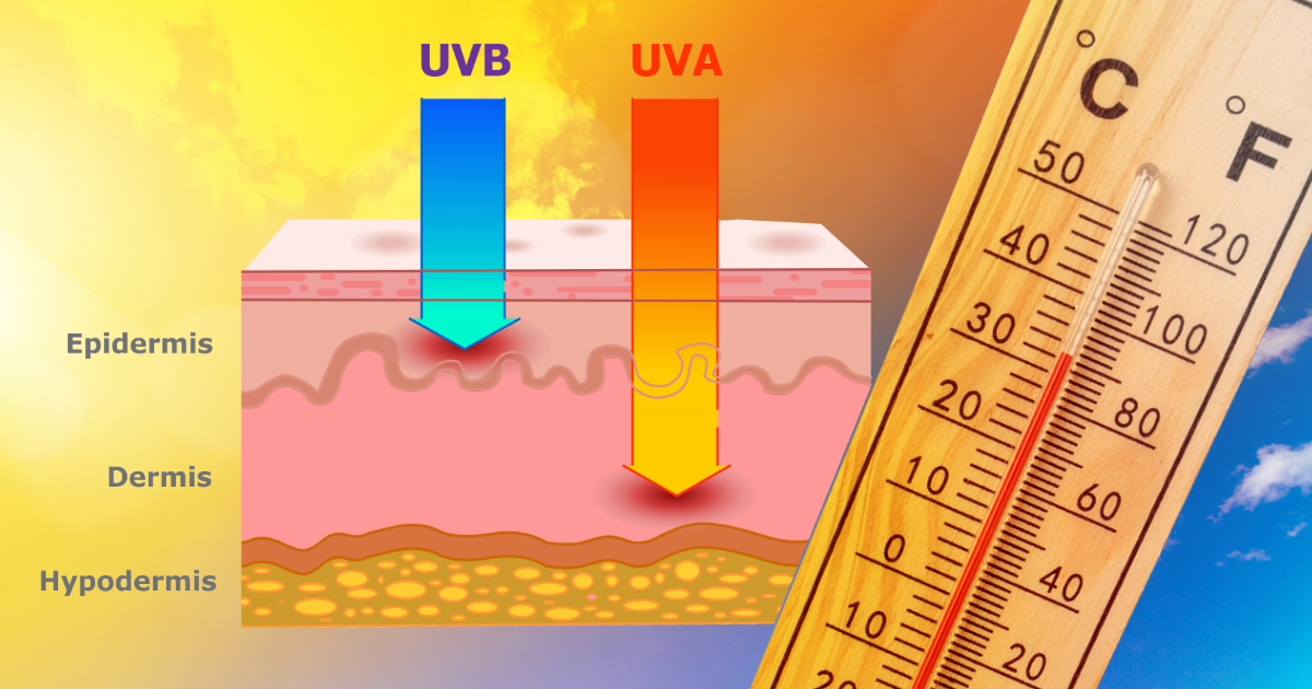 UV-Rays
