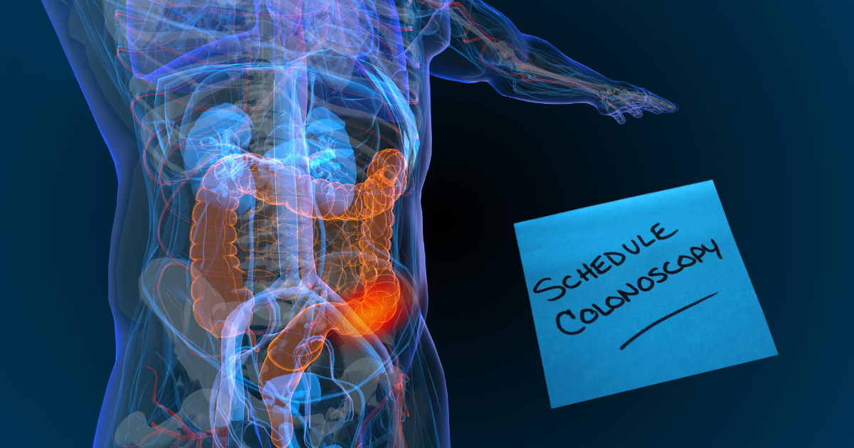 Colon-Cancer